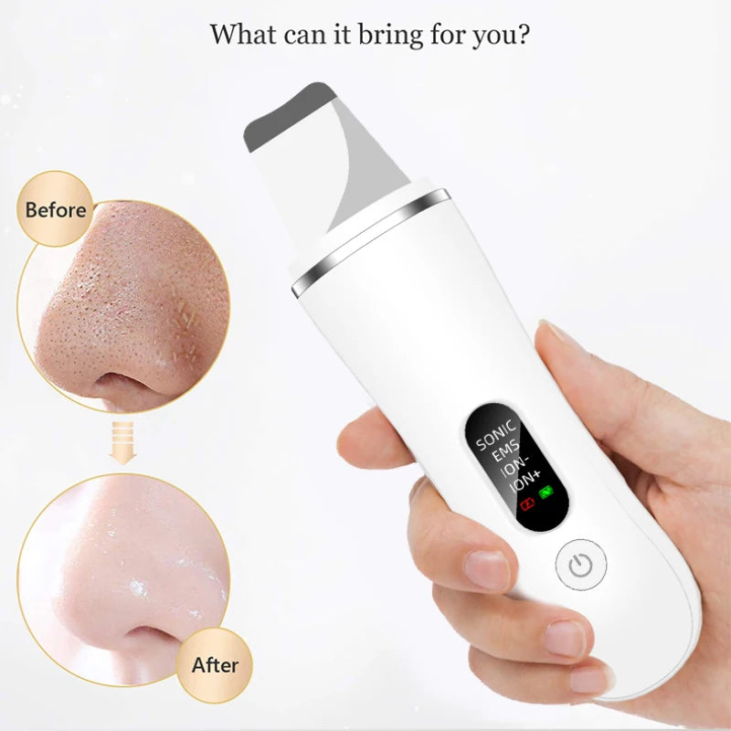 Ultrasonic Skin Scrubber Spatula, 4 Modes