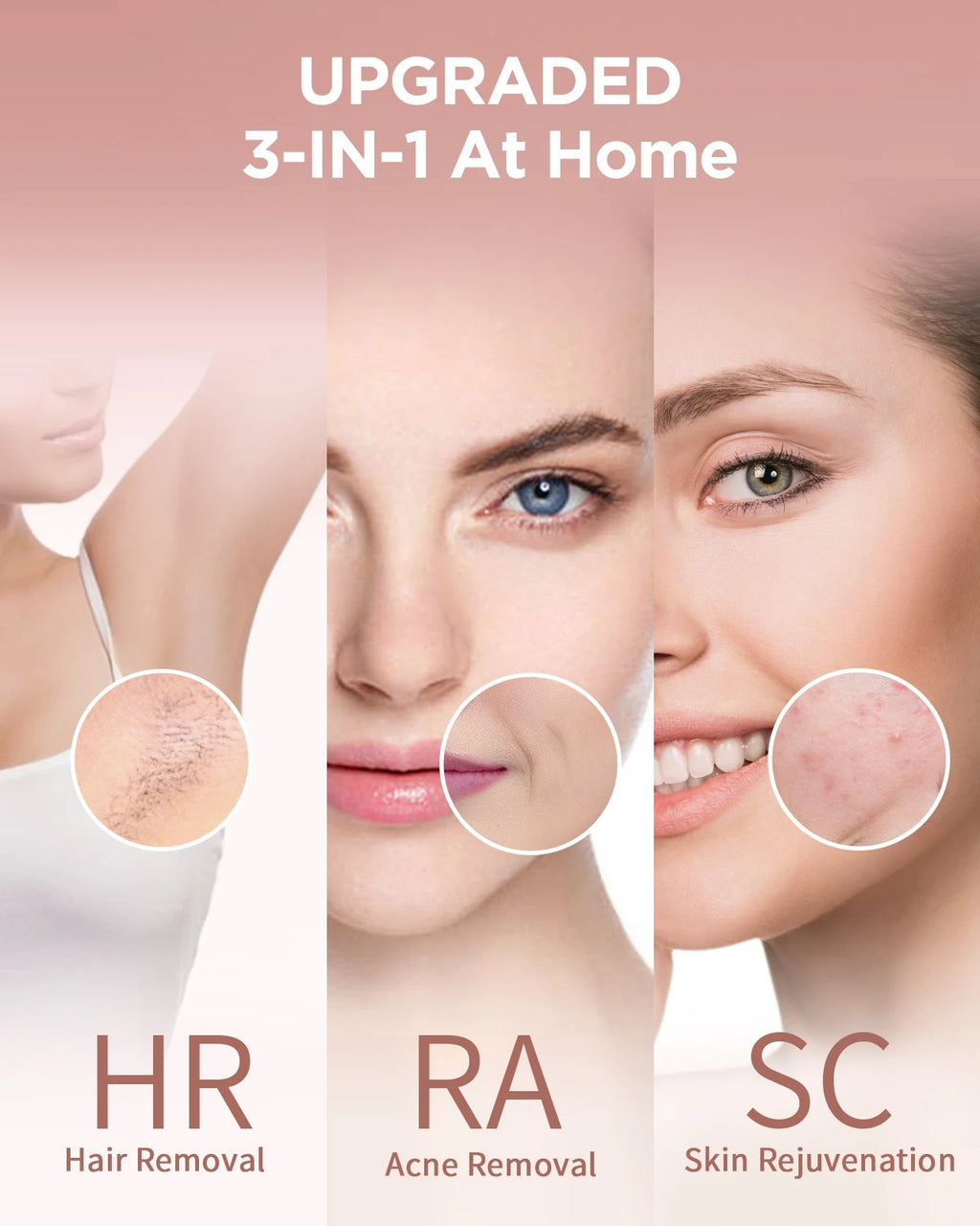 3-in-1 IPL Hair Removal, 5 cm² Window, 9 Levels