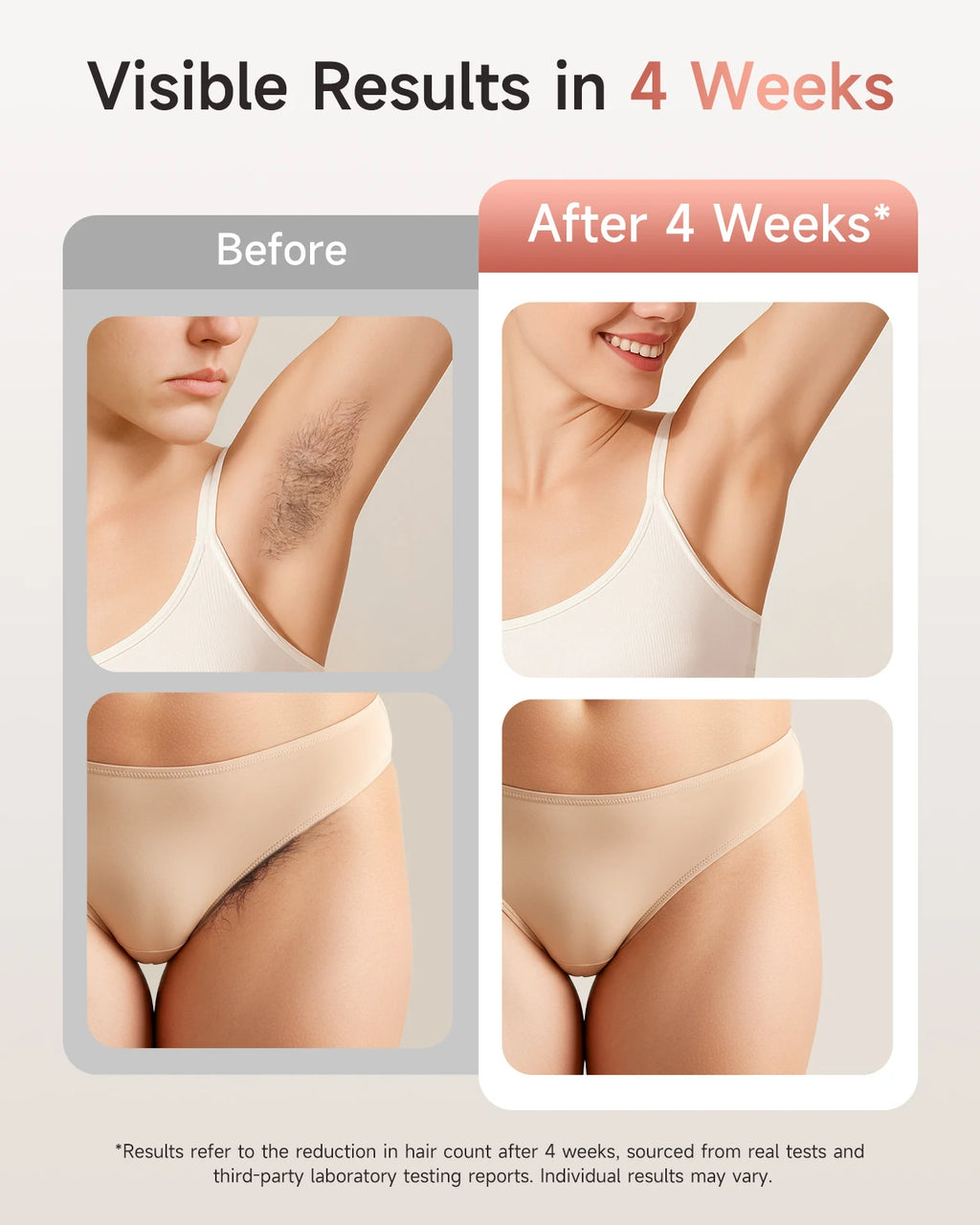 IPL Hair Removal, 9 Levels, HR SC RA, 999.9k