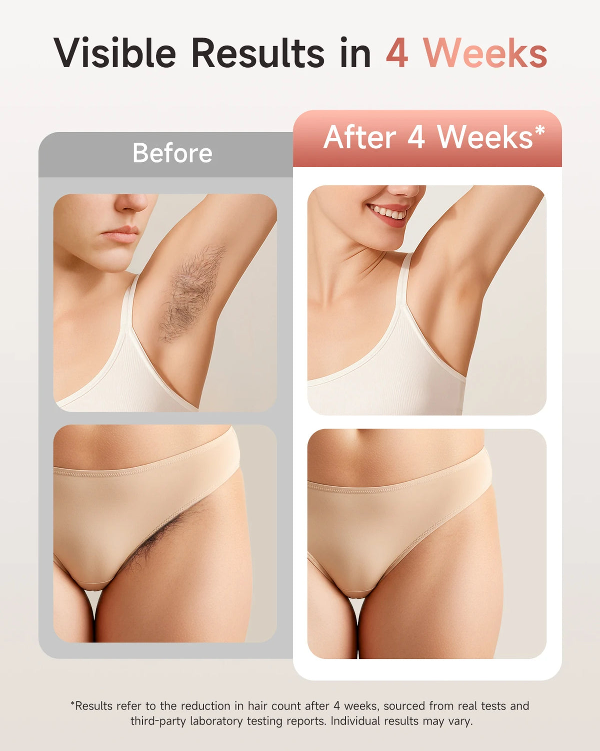 IPL Hair Removal, 9 Levels, HR SC RA, 999.9k