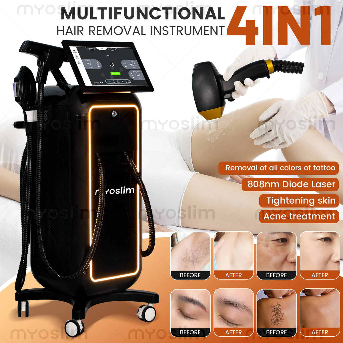 4-Wave Ice Diode Laser with RF, 755–1064 nm