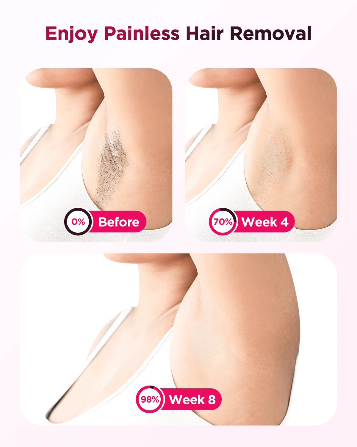 IPL Hair Removal Machine, 990k Flashes, 550–1200 nm