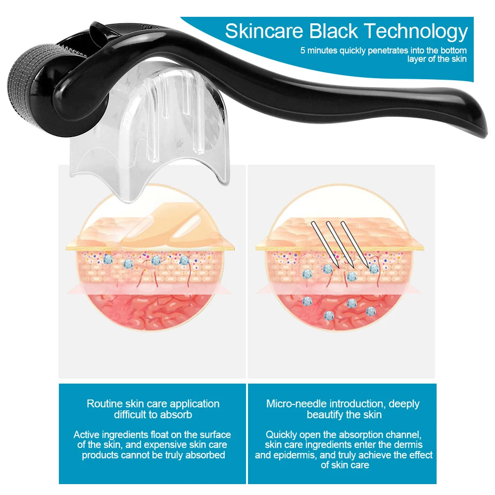540-Needle Derma Roller for Face and Scalp