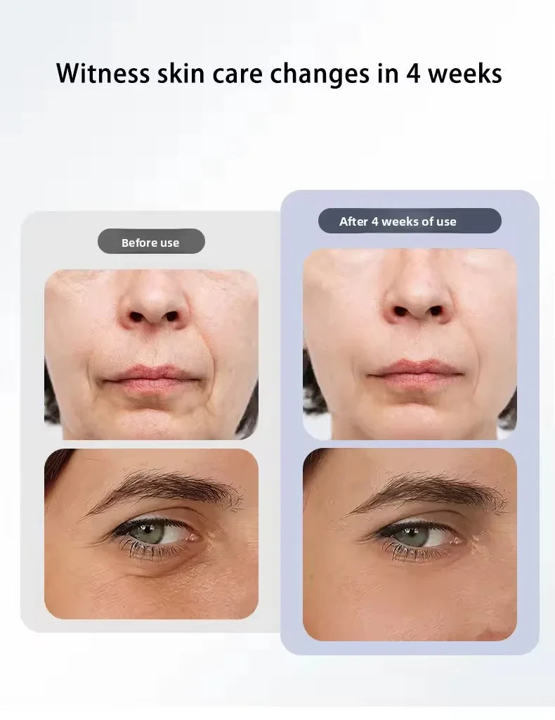 3-Level EMS Facial Toning Device for Face and Eye
