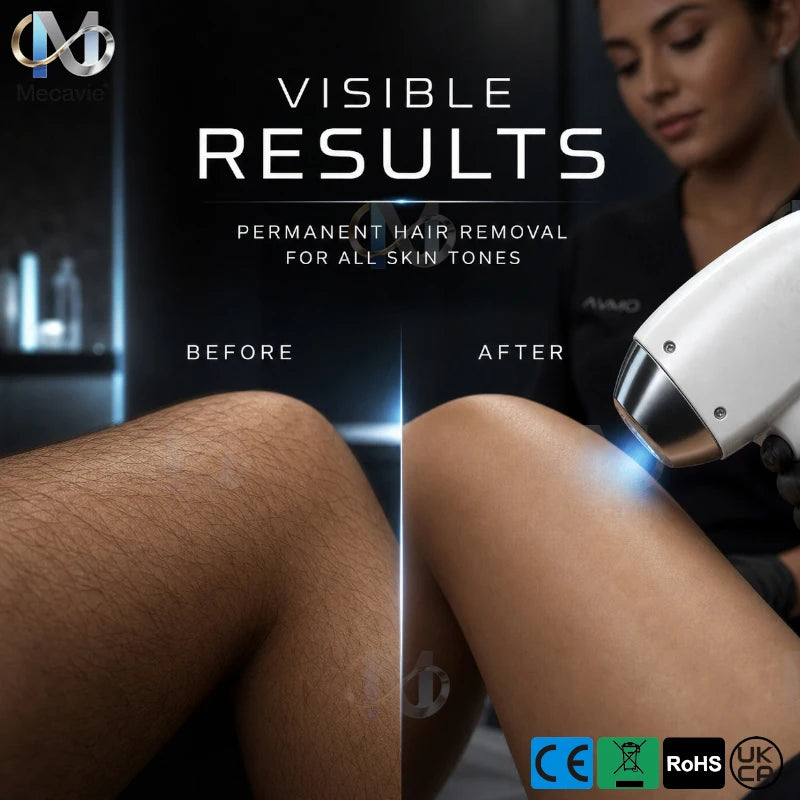 5000W 4-Wave Diode Laser Hair Removal, 755–1064 nm